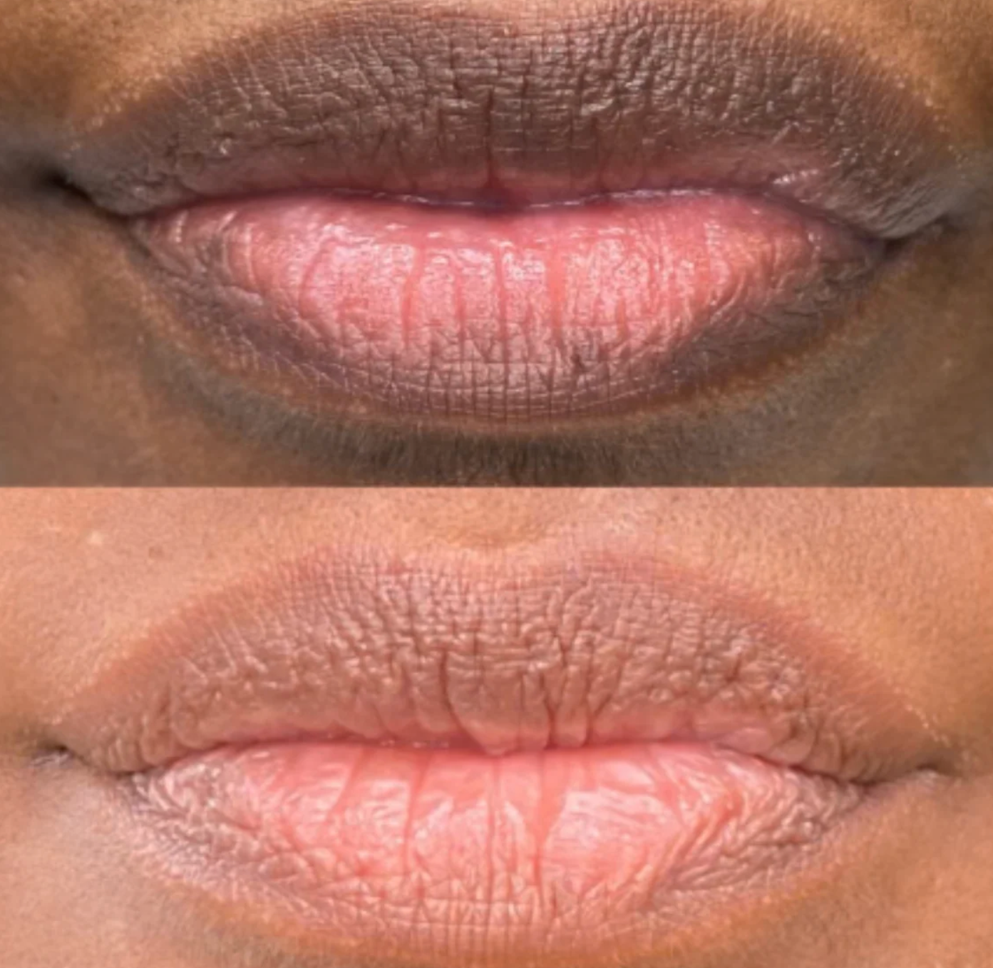 Bleamme's Dark Lips Brightening Serum