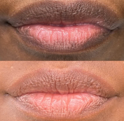 Bleamme's Dark Lips Brightening Serum